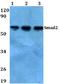 SMAD2 antibody, A00090S2, Boster Biological Technology, Western Blot image 
