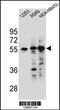 Syncoilin, Intermediate Filament Protein antibody, 55-432, ProSci, Western Blot image 