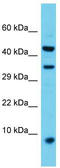 EDB antibody, TA342644, Origene, Western Blot image 