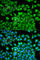 Fatty Acid Binding Protein 1 antibody, A5311, ABclonal Technology, Immunofluorescence image 