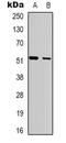 Lad antibody, LS-C368723, Lifespan Biosciences, Western Blot image 