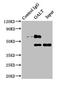 Galactose-1-Phosphate Uridylyltransferase antibody, LS-C317819, Lifespan Biosciences, Immunoprecipitation image 