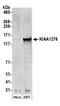 Family With Sequence Similarity 184 Member B antibody, A300-208A, Bethyl Labs, Western Blot image 