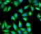 Myosin light chain 3 antibody, FNab09860, FineTest, Immunofluorescence image 