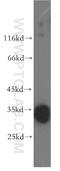 Deoxyribonuclease-1-like 1 antibody, 13653-1-AP, Proteintech Group, Western Blot image 