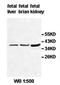 Adenosine A2b Receptor antibody, orb77499, Biorbyt, Western Blot image 