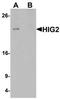 Hypoxia Inducible Lipid Droplet Associated antibody, orb75664, Biorbyt, Western Blot image 