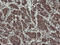 Zinc Finger C2HC-Type Containing 1A antibody, M16796, Boster Biological Technology, Immunohistochemistry paraffin image 