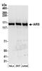 Isoleucyl-TRNA Synthetase antibody, A304-747A, Bethyl Labs, Western Blot image 