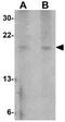 Zinc Finger BED-Type Containing 2 antibody, GTX85291, GeneTex, Western Blot image 