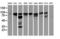 BCAR1 Scaffold Protein, Cas Family Member antibody, LS-C172803, Lifespan Biosciences, Western Blot image 