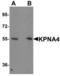 Karyopherin Subunit Alpha 4 antibody, LS-B5342, Lifespan Biosciences, Western Blot image 