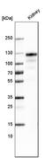 Angiotensin I Converting Enzyme 2 antibody, AMAb91259, Atlas Antibodies, Western Blot image 