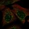 Prolyl-TRNA Synthetase 2, Mitochondrial antibody, HPA028308, Atlas Antibodies, Immunofluorescence image 