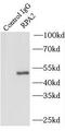 Replication Protein A2 antibody, FNab07392, FineTest, Immunoprecipitation image 