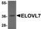 Elongation of very long chain fatty acids protein 7 antibody, TA306939, Origene, Western Blot image 