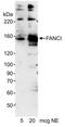 Fanconi anemia group I protein antibody, A300-212A, Bethyl Labs, Western Blot image 