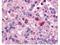 Protein artemis antibody, orb345299, Biorbyt, Immunohistochemistry paraffin image 