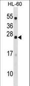Dynactin Associated Protein antibody, LS-C167965, Lifespan Biosciences, Western Blot image 