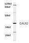 Galanin Receptor 2 antibody, AP01317PU-N, Origene, Western Blot image 