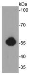 Aldehyde Dehydrogenase 2 Family Member antibody, NBP2-67132, Novus Biologicals, Western Blot image 