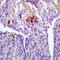 Cytomegalovirus 65 kDa Matrix Antigen antibody, orb10511, Biorbyt, Immunohistochemistry paraffin image 