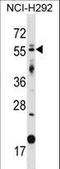 Zinc finger protein GLIS2 antibody, LS-C166504, Lifespan Biosciences, Western Blot image 