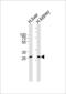 Enoyl-CoA Hydratase Domain Containing 3 antibody, PA5-49359, Invitrogen Antibodies, Western Blot image 