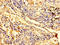 Zinc Finger Protein 559 antibody, A61962-100, Epigentek, Immunohistochemistry paraffin image 