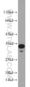 Nucleolar protein 3 antibody, 10846-2-AP, Proteintech Group, Western Blot image 
