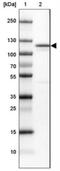 MORC Family CW-Type Zinc Finger 4 antibody, NBP1-82318, Novus Biologicals, Western Blot image 