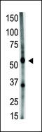Growth Differentiation Factor 5 antibody, LS-C97995, Lifespan Biosciences, Western Blot image 