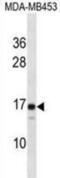 Lens fiber membrane intrinsic protein antibody, abx028680, Abbexa, Western Blot image 