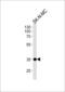 NK1 Homeobox 1 antibody, LS-C164893, Lifespan Biosciences, Western Blot image 