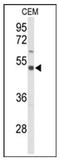 Solute Carrier Family 39 Member 8 antibody, AP53783PU-N, Origene, Western Blot image 