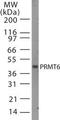 Protein Arginine Methyltransferase 6 antibody, TA336434, Origene, Western Blot image 
