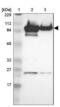 A-Kinase Anchoring Protein 8 antibody, NBP1-90196, Novus Biologicals, Western Blot image 