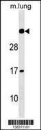 N(Alpha)-Acetyltransferase 60, NatF Catalytic Subunit antibody, 59-839, ProSci, Western Blot image 