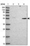 Coronin 2A antibody, PA5-59458, Invitrogen Antibodies, Western Blot image 