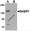 NEDD4 Binding Protein 1 antibody, 6175, ProSci Inc, Western Blot image 