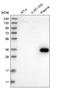 Zinc Finger Protein 101 antibody, HPA023449, Atlas Antibodies, Western Blot image 