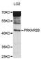 Protein Kinase CAMP-Dependent Type II Regulatory Subunit Beta antibody, STJ114624, St John