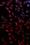 Carboxypeptidase E antibody, GTX33060, GeneTex, Immunofluorescence image 
