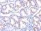Tumor Susceptibility 101 antibody, NB200-112, Novus Biologicals, Immunohistochemistry frozen image 