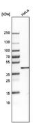 Serine And Arginine Rich Splicing Factor 5 antibody, NBP1-92381, Novus Biologicals, Western Blot image 