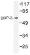Dystrophin Related Protein 2 antibody, AP01367PU-N, Origene, Western Blot image 