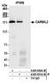 Capping Protein Regulator And Myosin 1 Linker 2 antibody, A305-830A-M, Bethyl Labs, Immunoprecipitation image 