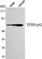 General Transcription Factor IIH Subunit 1 antibody, A05408-1, Boster Biological Technology, Western Blot image 