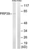 Pre-MRNA Processing Factor 39 antibody, abx014738, Abbexa, Western Blot image 