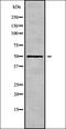 Interferon Induced Protein 44 antibody, orb337757, Biorbyt, Western Blot image 